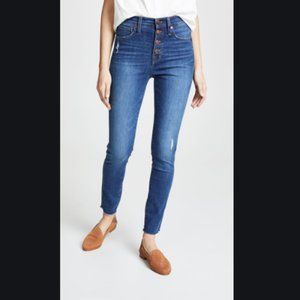 Madewell 10" Button Fly Jeans